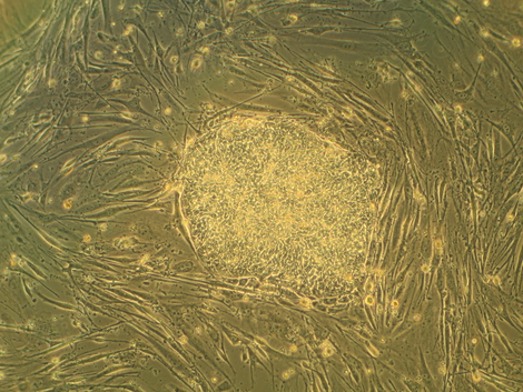 Price’s nomination casts doubt on future research into human embryonic stem cells. (Image: Wikimedia)